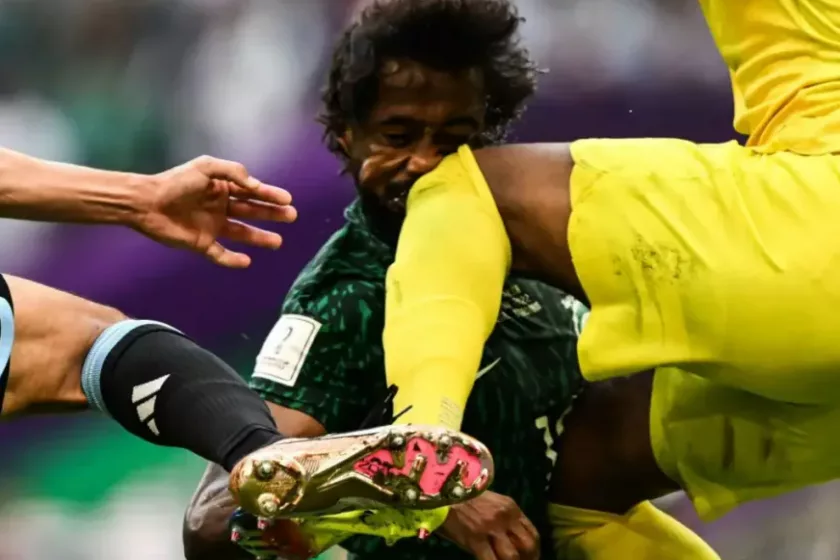 Megműtötték a szaúdi futballistát, akit kapusa térdelt fejen az argentinok ellen
